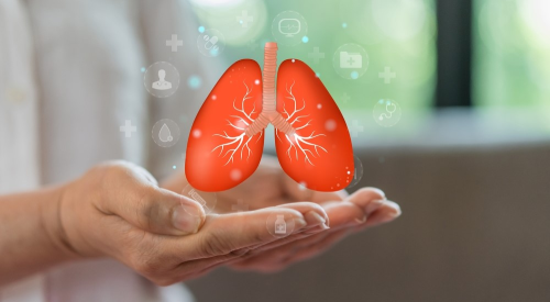 Doença Pulmonar Obstrutiva Crónica